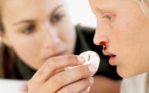Причины носовых кровотечений у детей